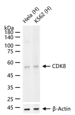 CDK8 Antibody in Western Blot (WB)