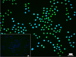 SF1 Recombinant Rabbit Monoclonal Antibody (E1F12)