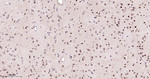 SF1 Antibody in Immunohistochemistry (Paraffin) (IHC (P))