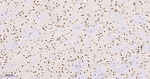 SF1 Antibody in Immunohistochemistry (Paraffin) (IHC (P))