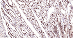 SF1 Antibody in Immunohistochemistry (Paraffin) (IHC (P))