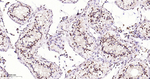 SF1 Antibody in Immunohistochemistry (Paraffin) (IHC (P))