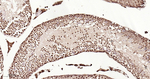 SF1 Antibody in Immunohistochemistry (Paraffin) (IHC (P))
