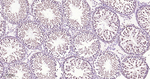 SF1 Antibody in Immunohistochemistry (Paraffin) (IHC (P))
