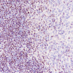 SATB1 Antibody in Immunohistochemistry (Paraffin) (IHC (P))