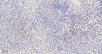 SATB1 Antibody in Immunohistochemistry (Paraffin) (IHC (P))