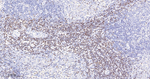 SATB1 Antibody in Immunohistochemistry (Paraffin) (IHC (P))