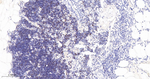 SATB1 Antibody in Immunohistochemistry (Paraffin) (IHC (P))