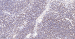 SATB1 Antibody in Immunohistochemistry (Paraffin) (IHC (P))