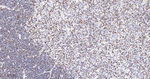 SATB1 Antibody in Immunohistochemistry (Paraffin) (IHC (P))