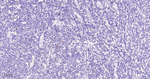 SATB1 Antibody in Immunohistochemistry (Paraffin) (IHC (P))