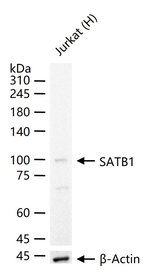 SATB1 Antibody in Western Blot (WB)