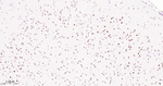 SMARCA2 Recombinant Rabbit Monoclonal Antibody (E7F8)