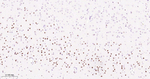 SMARCA2 Antibody in Immunohistochemistry (Paraffin) (IHC (P))