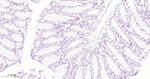 SMARCA2 Antibody in Immunohistochemistry (Paraffin) (IHC (P))