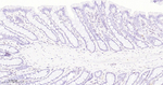 SMARCA2 Antibody in Immunohistochemistry (Paraffin) (IHC (P))