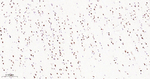 SMARCA2 Antibody in Immunohistochemistry (Paraffin) (IHC (P))