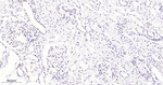 SMARCA2 Antibody in Immunohistochemistry (Paraffin) (IHC (P))