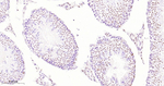 SMARCA2 Antibody in Immunohistochemistry (Paraffin) (IHC (P))