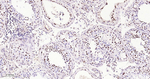 SMARCA2 Antibody in Immunohistochemistry (Paraffin) (IHC (P))