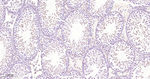 SMARCA2 Antibody in Immunohistochemistry (Paraffin) (IHC (P))