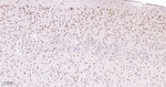 SOX11 Antibody in Immunohistochemistry (Paraffin) (IHC (P))