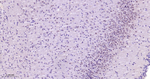 SOX11 Antibody in Immunohistochemistry (Paraffin) (IHC (P))