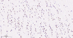 SOX11 Recombinant Rabbit Monoclonal Antibody (B10G9)