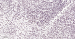 SOX11 Antibody in Immunohistochemistry (Paraffin) (IHC (P))