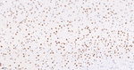 FUBP1 Antibody in Immunohistochemistry (Paraffin) (IHC (P))