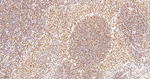 FUBP1 Antibody in Immunohistochemistry (Paraffin) (IHC (P))