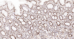FUBP1 Antibody in Immunohistochemistry (Paraffin) (IHC (P))