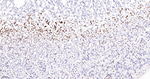 FUBP1 Antibody in Immunohistochemistry (Paraffin) (IHC (P))