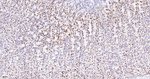 FUBP1 Antibody in Immunohistochemistry (Paraffin) (IHC (P))