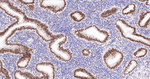 FUBP1 Antibody in Immunohistochemistry (Paraffin) (IHC (P))