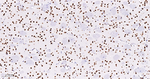 FUBP1 Antibody in Immunohistochemistry (Paraffin) (IHC (P))