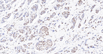 FUBP1 Antibody in Immunohistochemistry (Paraffin) (IHC (P))
