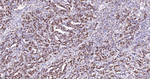 FUBP1 Antibody in Immunohistochemistry (Paraffin) (IHC (P))