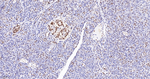 FUBP1 Antibody in Immunohistochemistry (Paraffin) (IHC (P))