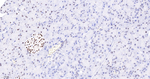 FUBP1 Antibody in Immunohistochemistry (Paraffin) (IHC (P))