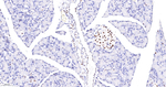 FUBP1 Antibody in Immunohistochemistry (Paraffin) (IHC (P))