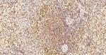 FUBP1 Antibody in Immunohistochemistry (Paraffin) (IHC (P))