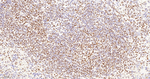FUBP1 Antibody in Immunohistochemistry (Paraffin) (IHC (P))