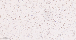 RPA2 Antibody in Immunohistochemistry (Paraffin) (IHC (P))