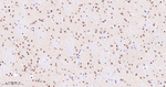 RPA2 Antibody in Immunohistochemistry (Paraffin) (IHC (P))