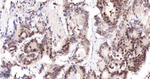 RPA2 Antibody in Immunohistochemistry (Paraffin) (IHC (P))