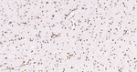 RPA2 Antibody in Immunohistochemistry (Paraffin) (IHC (P))