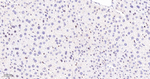 RPA2 Antibody in Immunohistochemistry (Paraffin) (IHC (P))
