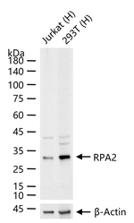 RPA2 Antibody in Western Blot (WB)
