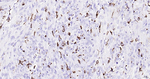 CD68 Antibody in Immunohistochemistry (Paraffin) (IHC (P))